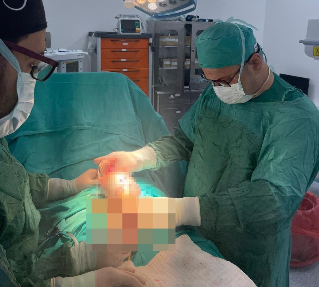 Testis'ten 20 santimetre dev tümör çıkarıldı! Uzmanlar: 