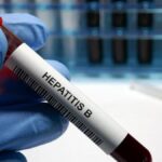 Hepatit B Belirtileri Nelerdir? Hepatit B Nasıl Anlaşılır? Tedavi Yöntemleri Nelerdir?