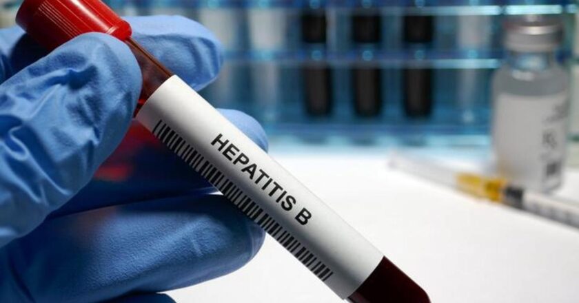 Hepatit B Belirtileri Nelerdir? Hepatit B Nasıl Anlaşılır? Tedavi Yöntemleri Nelerdir?